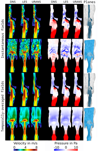 KW07_Publikation_MedFlow_Larynx_PhilippBerg